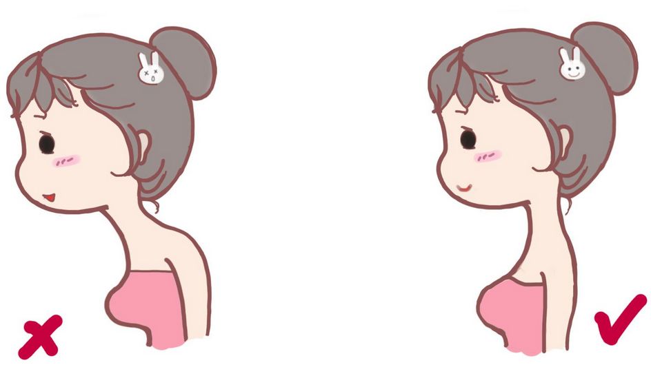 如何改善驼背最有效的方法瑜伽,如何改善驼背骨科医生教你