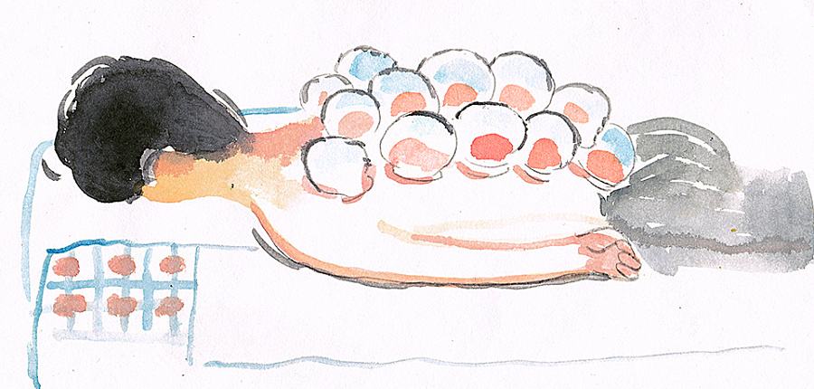 拔罐的知识你知道多少