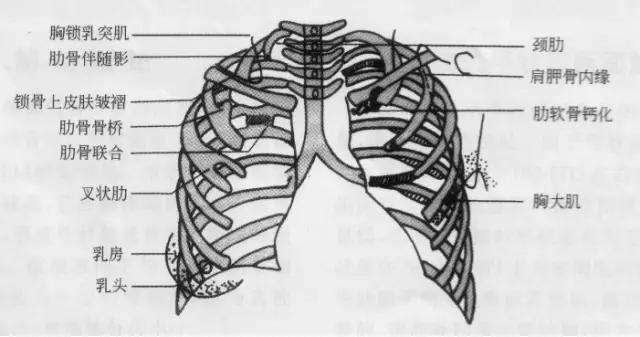 详细的胸部X线解剖，最基础最实用！