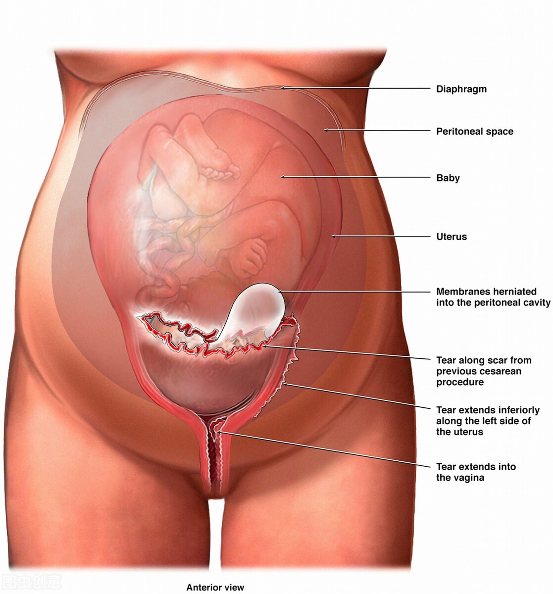 产后出血的评估,产后出血的护理评估要点