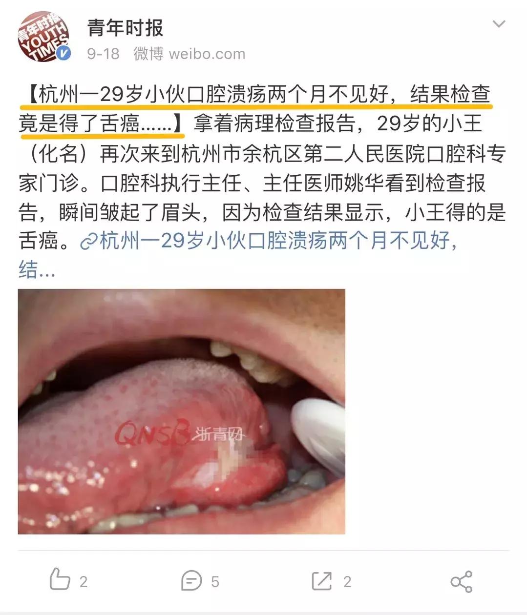嘴上长了一个巨大的口腔溃疡,嘴皮上长了个口腔溃疡