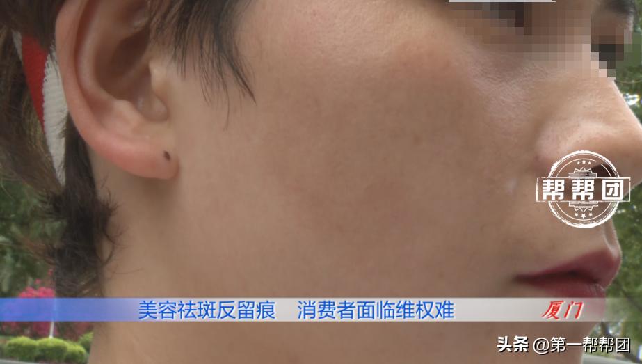 去美容店祛斑有效吗,去美容店做祛斑靠谱吗