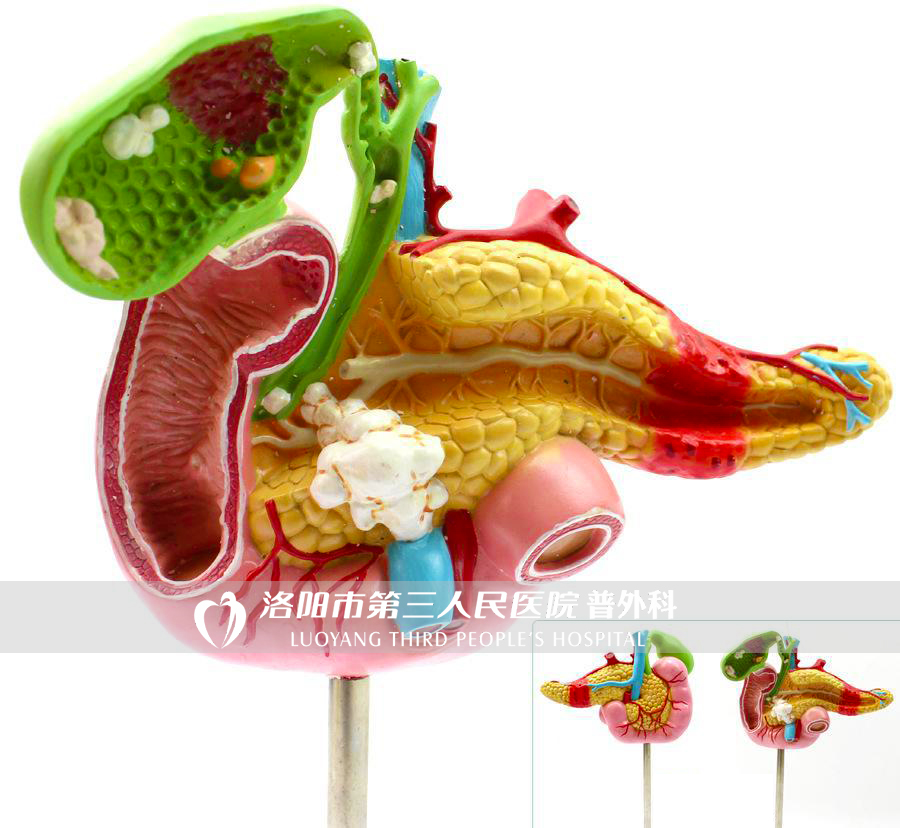 医学专家谈胰腺癌为什么这么可怕,为啥年轻人得了胰腺癌太惨了