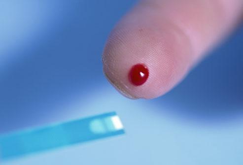 涨姿势！男性勃起障碍很可怕？听过用松紧带和真空泵