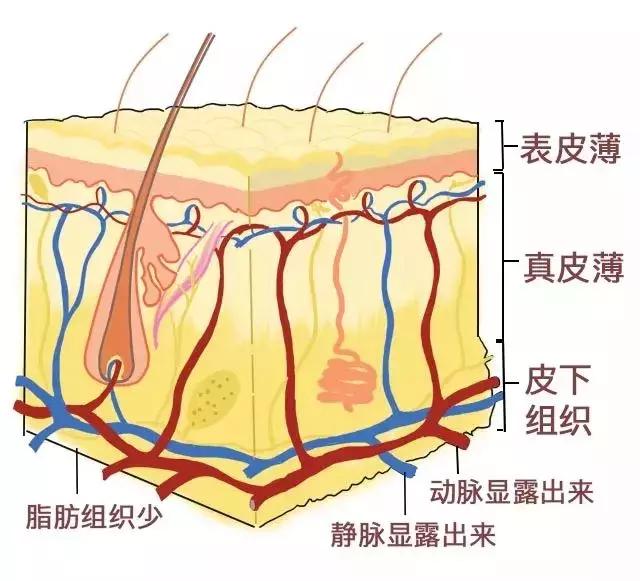 咖啡因淡化什么类型黑眼圈,黑眼圈三种类型你属于哪种