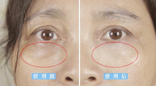 淡化眼纹黑眼圈的方法,女人眼睛看起来很显老要怎样调理