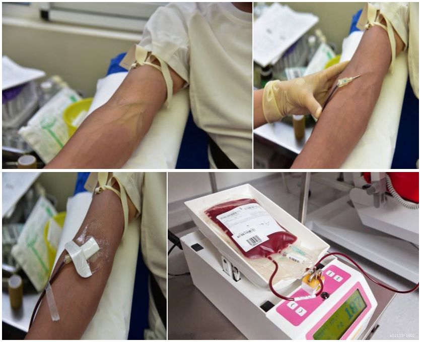 马康:术中自体血液回收