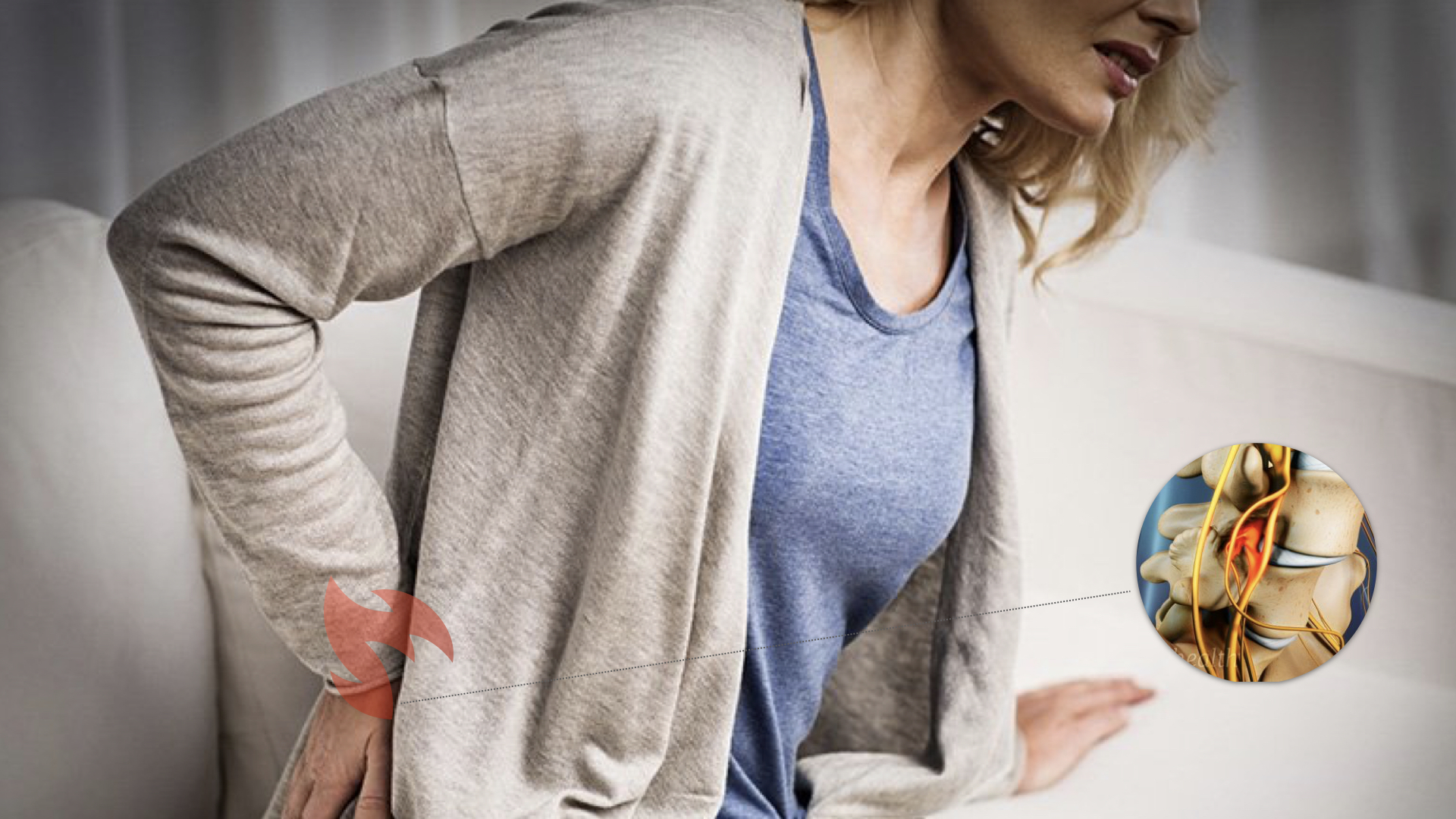 椎间盘突出痛苦,慢性腰椎间盘突出