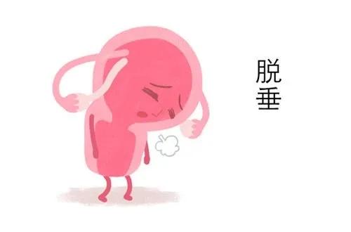 子宫脱垂的症状及危害你知道吗,孕期子宫脱垂的症状及危害