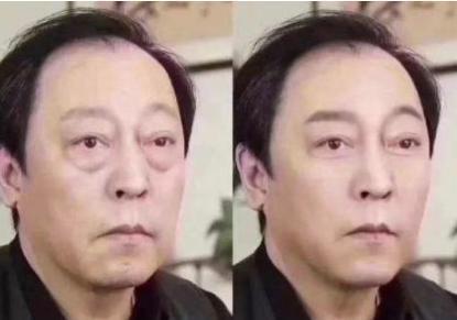 戚薇力荐的眼霜,用后黑眼圈细纹都没了,李佳琦:确实不错