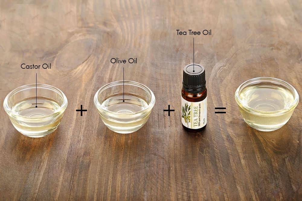 祛痘印不淡化黑色素,祛痘印长期不褪色