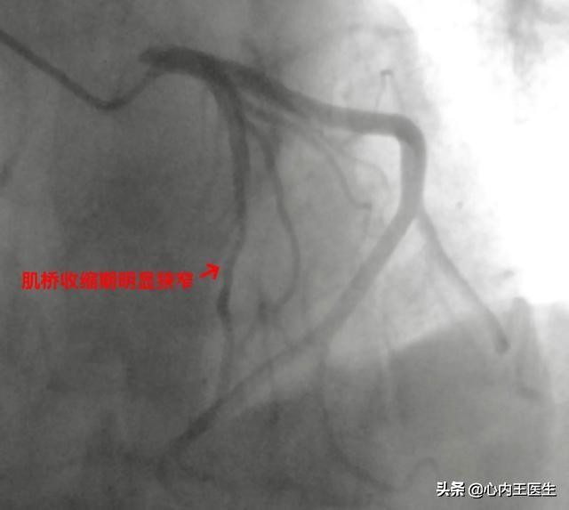 心慌发作怎么急救,反复心慌气短怎么回事