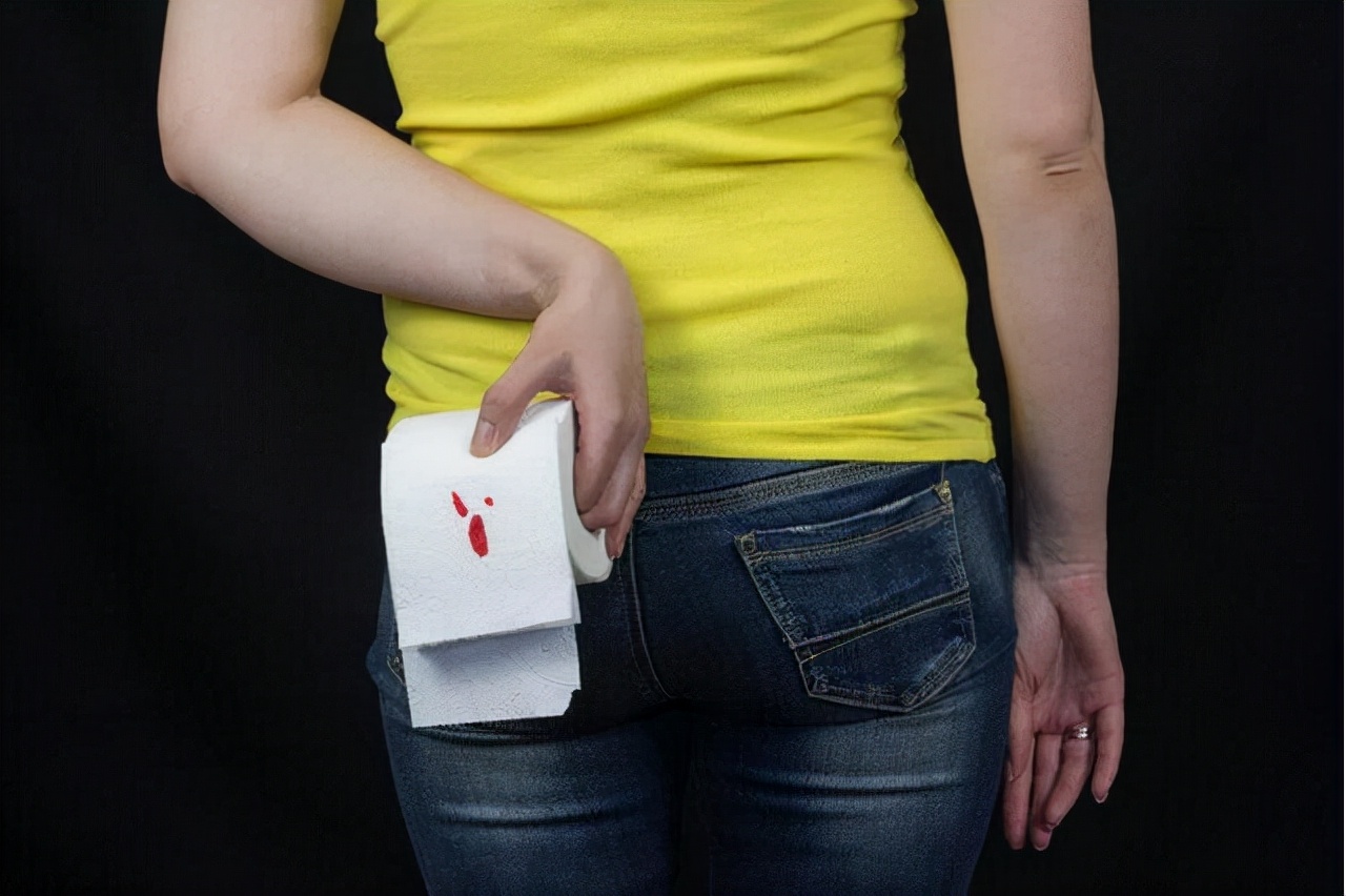 肛门外面的小肉球是痔疮吗,肛门口有个小肉球是什么痔疮