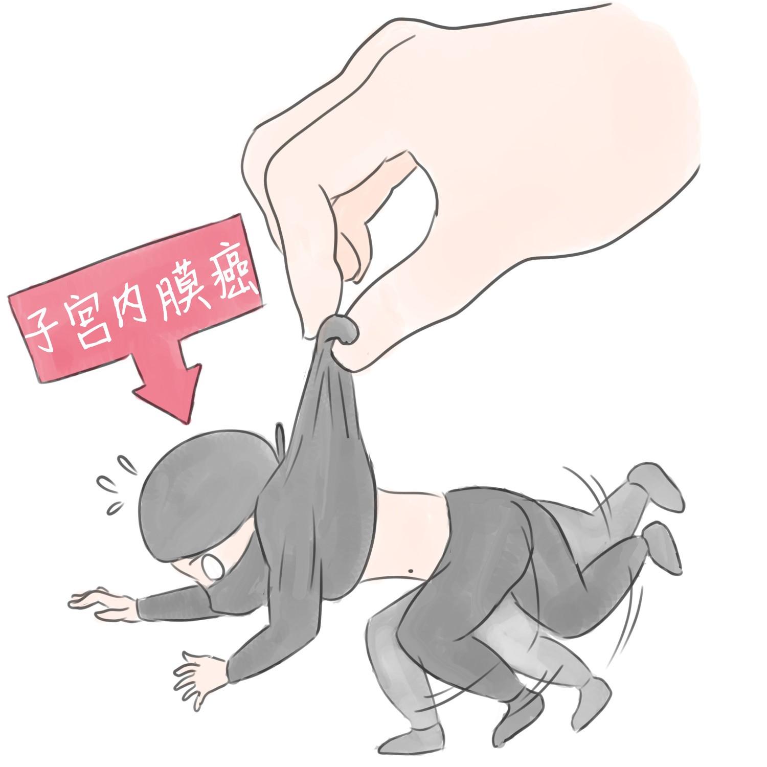 谈癌色变属于条件反射吗,谈癌色变怎么解释