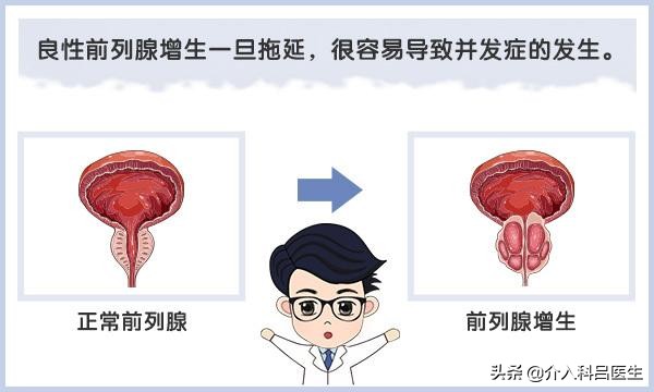 前列腺介入栓塞术和电切的区别,前列腺增生介入治疗