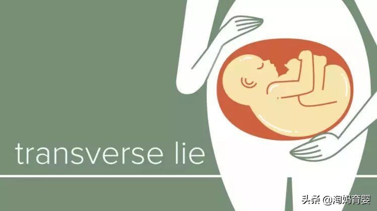 胎位什么时候能固定,怀双胞胎一般几周胎位开始固定