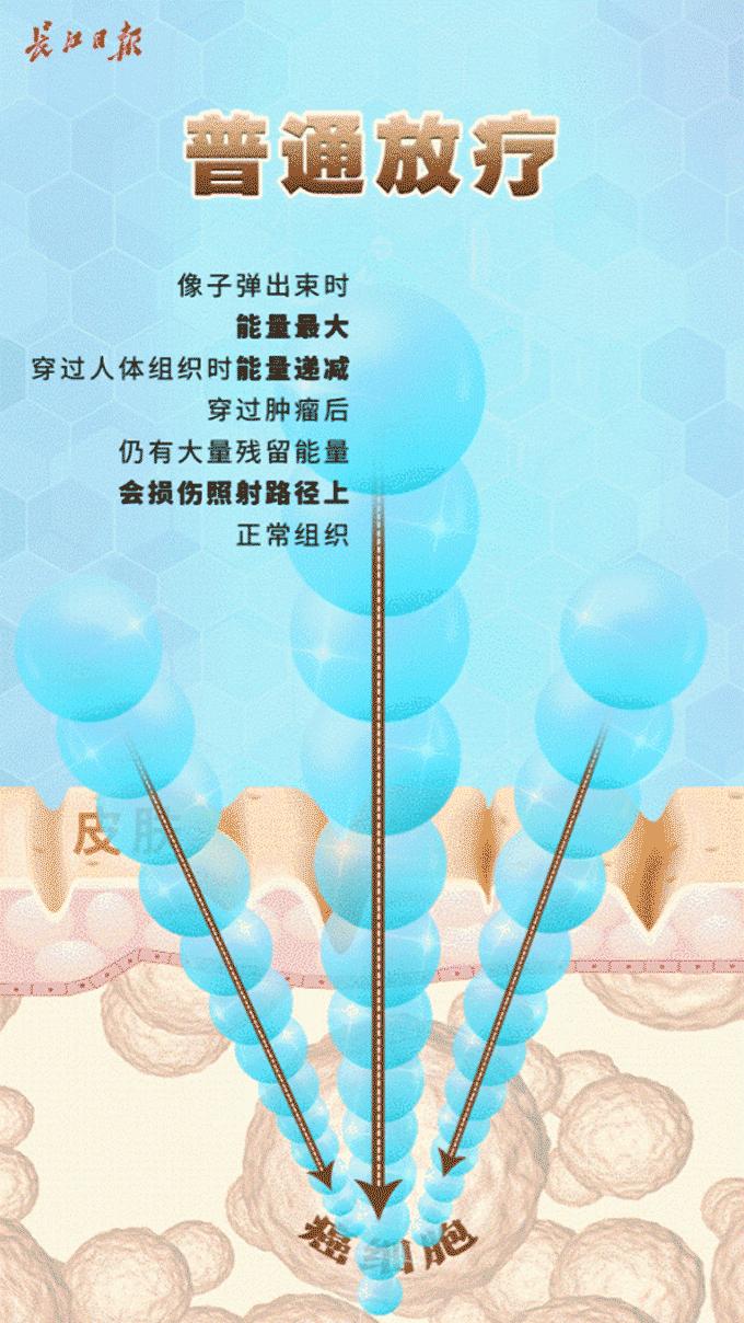 重离子中心武汉市,武汉重离子治愈癌症