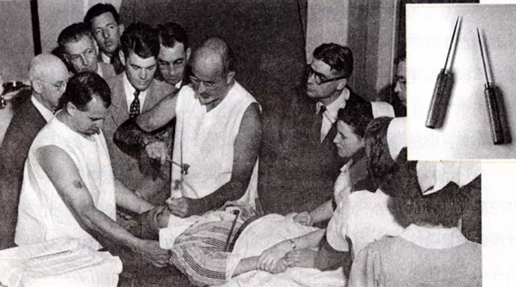 放血和灌肠疗法,灌肠放血的正确方法是什么