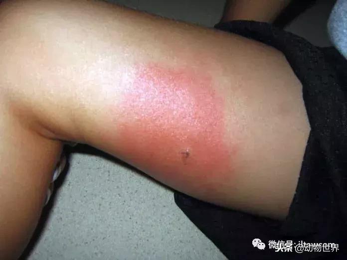 蝎子的全名叫什么,蝎子百科全书