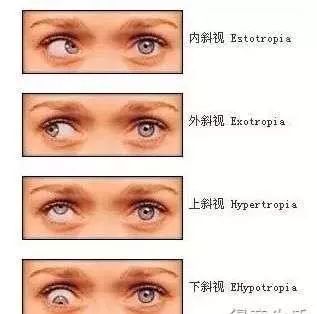 儿童眼科常见病有哪些,家长收藏孩子生病要用的药物