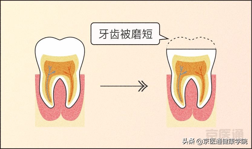 夜磨牙有什么危害吗,夜磨牙的危害