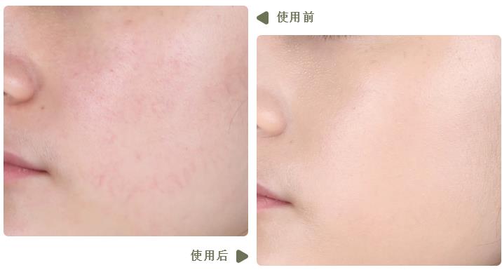 测大牌气垫,五款大热气垫真实测评