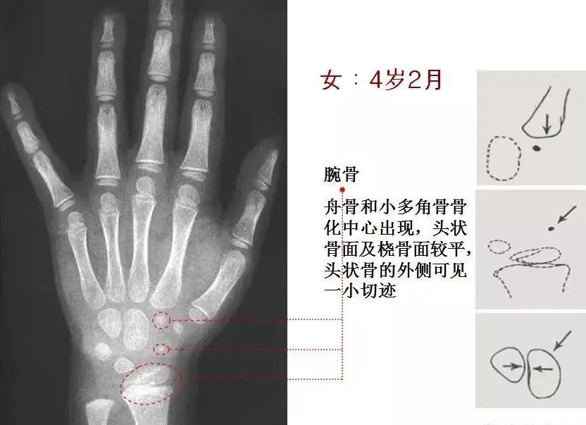 孩子个子高却跑不快,孩子个头不高怎么办
