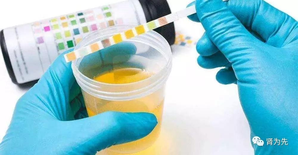 肾病拉肚子尿蛋白会升高么,肾病患者吃凉东西会尿蛋白升高吗