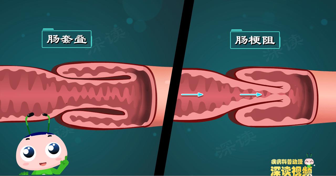 宝宝脚上腿上紫癜早上醒来就减轻,孩子腿上有红疹小心是过敏性紫癜