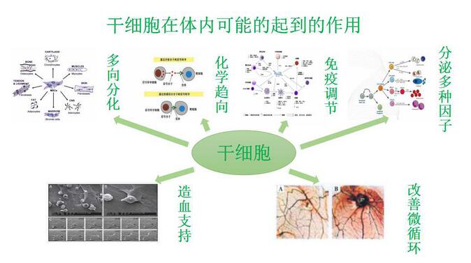 干细胞移植肝硬化研究进展,肝硬化晚期干细胞移植能维持多久