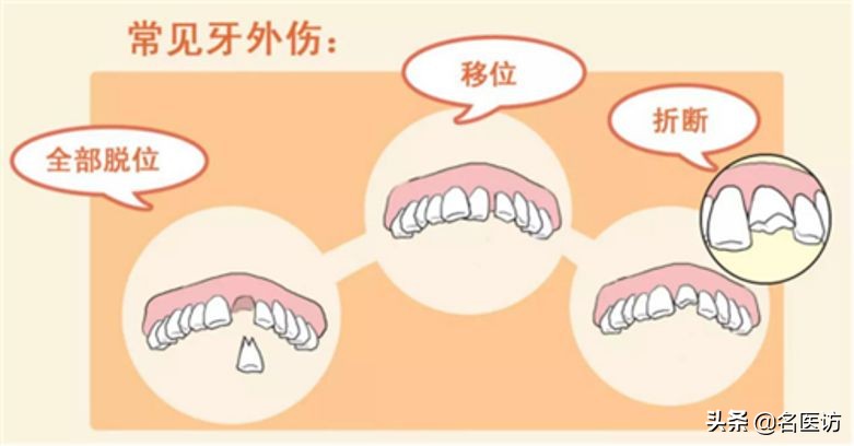 疫情牙痛怎么治疗,疫情期间牙痛用药怎么办