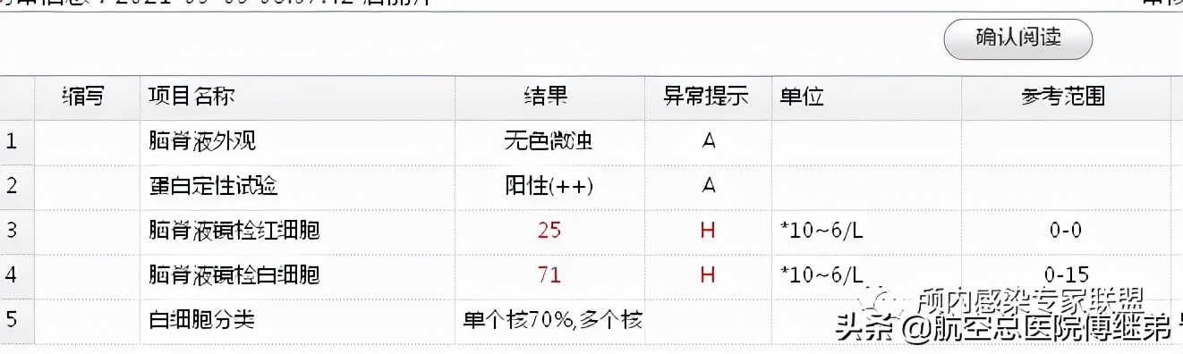 婴儿脑积水治疗方法动画演示,ommaya囊植入术是大手术吗