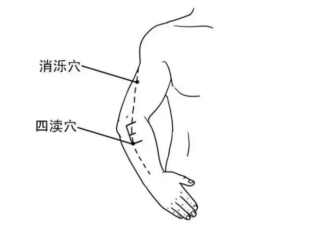 胡希恕经方治疗乳腺增生,中医治疗乳腺增生的处方