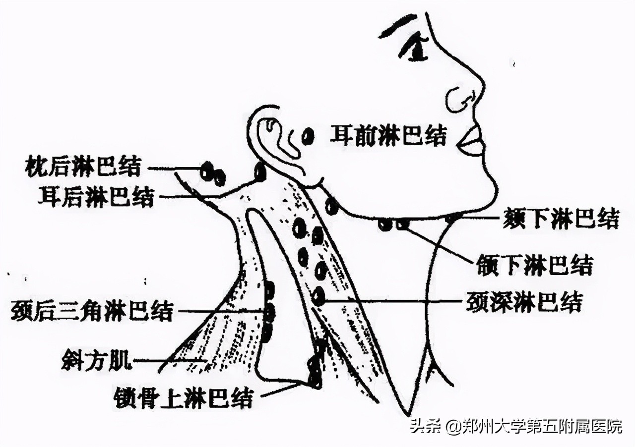 小小淋巴细胞,淋巴结有很多小小的会影响生命吗