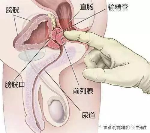 前列腺活检报告案例,前列腺检查报告单标准模板