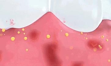 一张嘴臭牙齿就臭怎么办,一张嘴就口臭小妙招