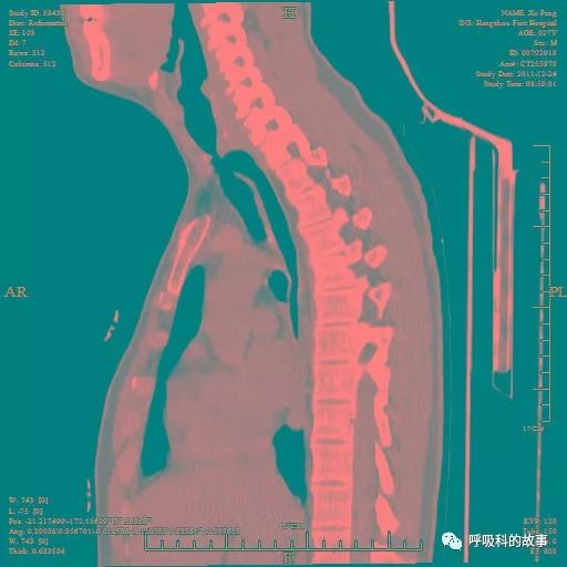 平台型的变化是什么,平台功能有什么新的变化