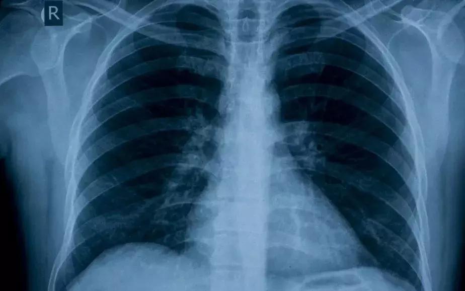 这些常用药紧急召回赶紧自查,全国停售紧急召回的四种药