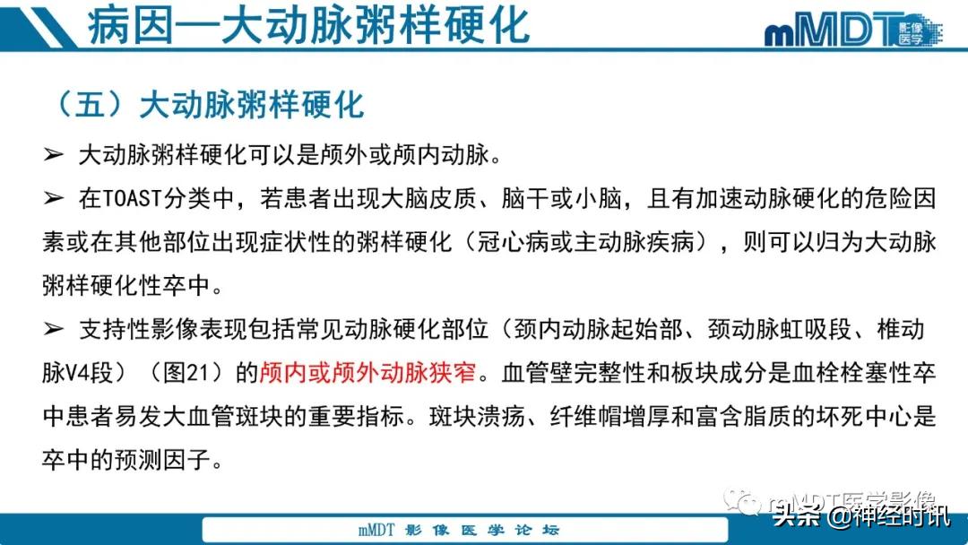 急性缺血性脑卒中ppt素材图片,青年缺血性脑卒中ppt