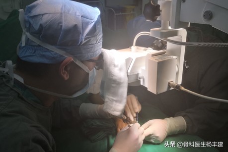 股骨骨折钢板断裂原因分析,骨折钢板在什么情况下容易断裂