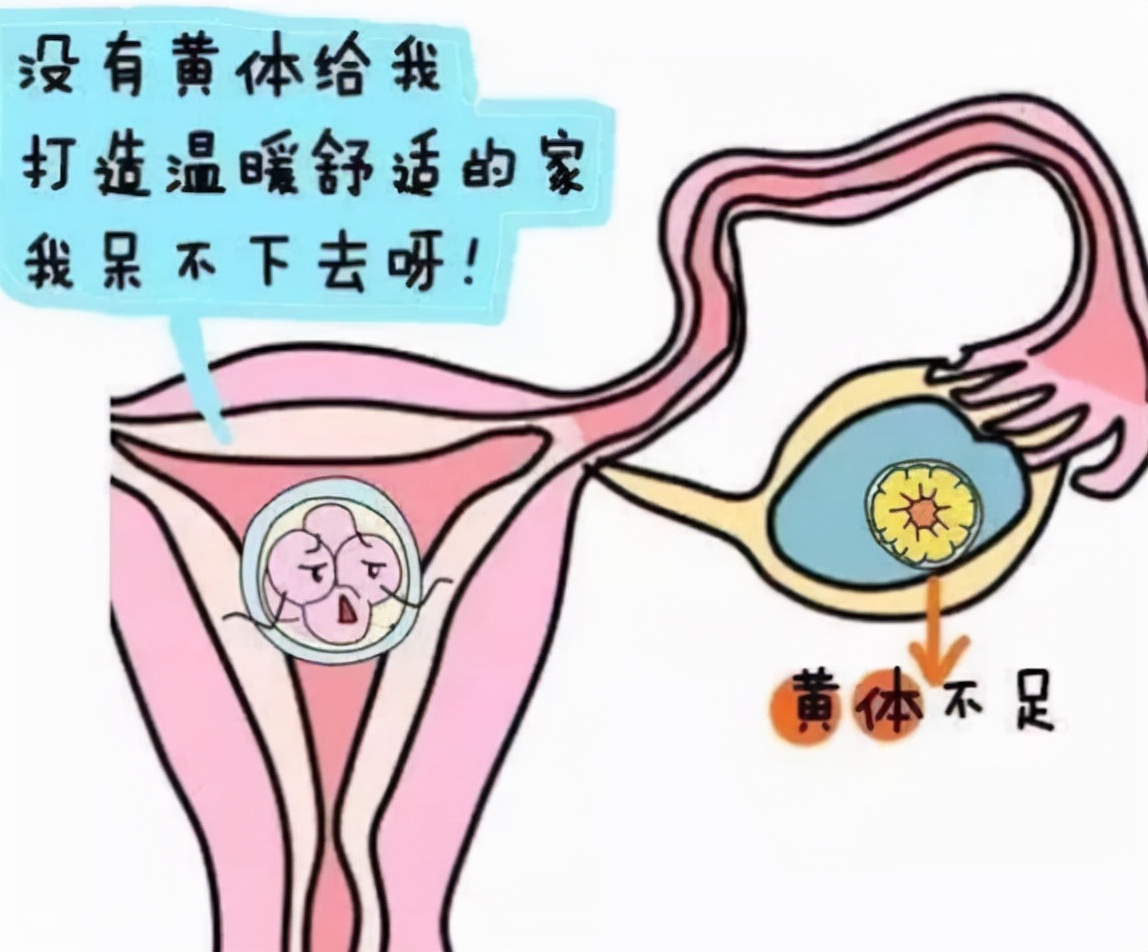 一天接了3个急诊，都是黄体破裂，黄体到底是什么？女性该了解下