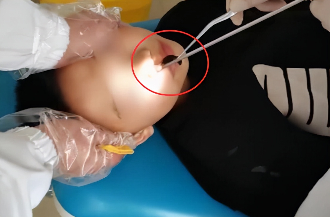 如果蚂蟥进入呼吸道能存活多久,蚂蟥寄生到体内多久能长大