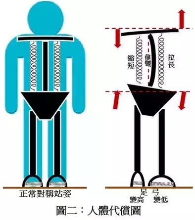 长短脚可以推拿正骨矫正吗,长短脚的矫正手法视频