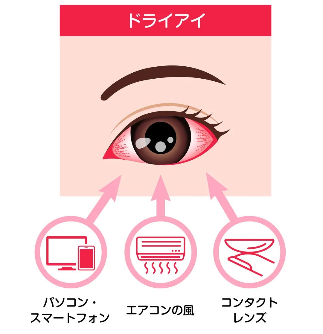 眼霜去眼纹的最好方法,眼纹严重适合的眼霜怎么去掉