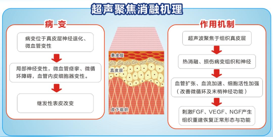 外阴瘙痒怎么确定是哪种炎症,外阴瘙痒怎么判断是哪一种炎症