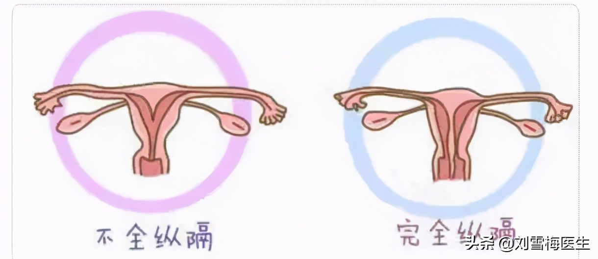 子宫内膜薄怀孕了怎么办,想怀孕但是子宫内膜异位症