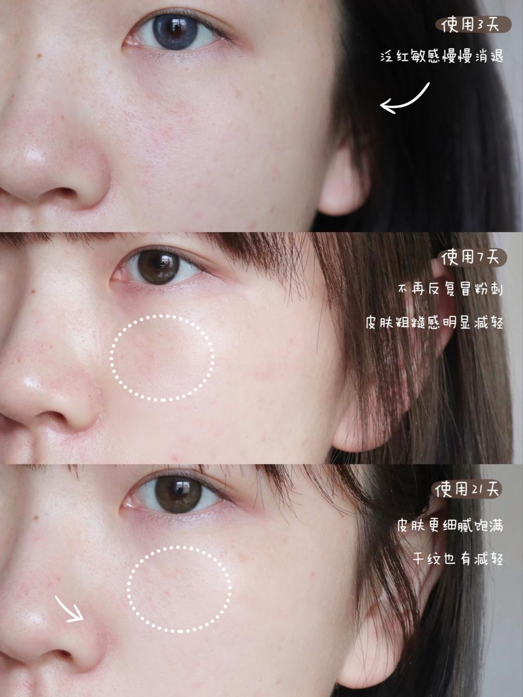 面霜大牌推荐排行榜第一名,娇兰面霜哪个系列最好