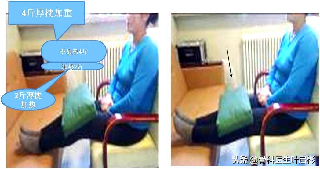 老年人骨折危险在哪里,如何辨别老年人是否骨折