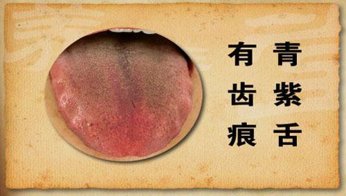 望舌知病实操完整版,教你看舌辨病