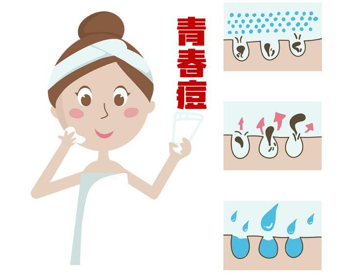 顽固痘痘怎么办教你一招正确祛痘,痘痘破了反复长不停如何正确祛痘